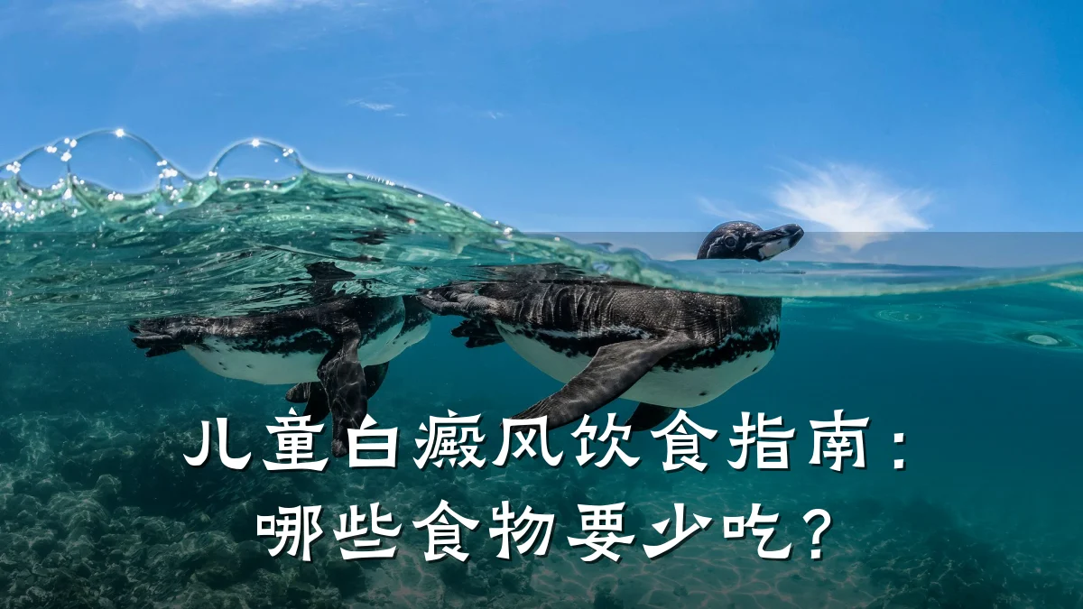 儿童白癜风饮食指南：哪些食物要少吃？